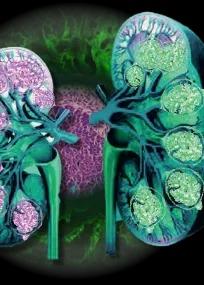 Glomerulonephritis Conference cover image