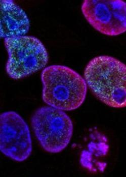 Cancer and the host Conference Cover Image